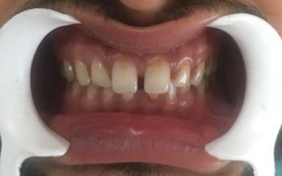 orthodontics